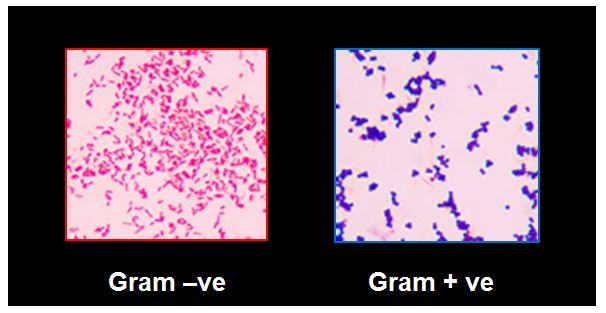 Gram ve and ve